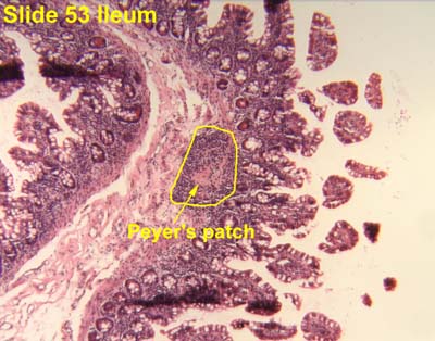 Histology Of Ileum Peyers Patches